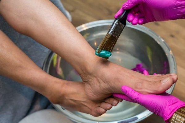 Comment réduire l'apparence des veines apparentes sur les jambes avec des soins naturels ?